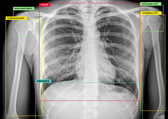 healthcare industry annotation